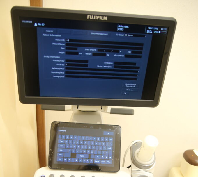 超音波（エコー） 検査診断装置